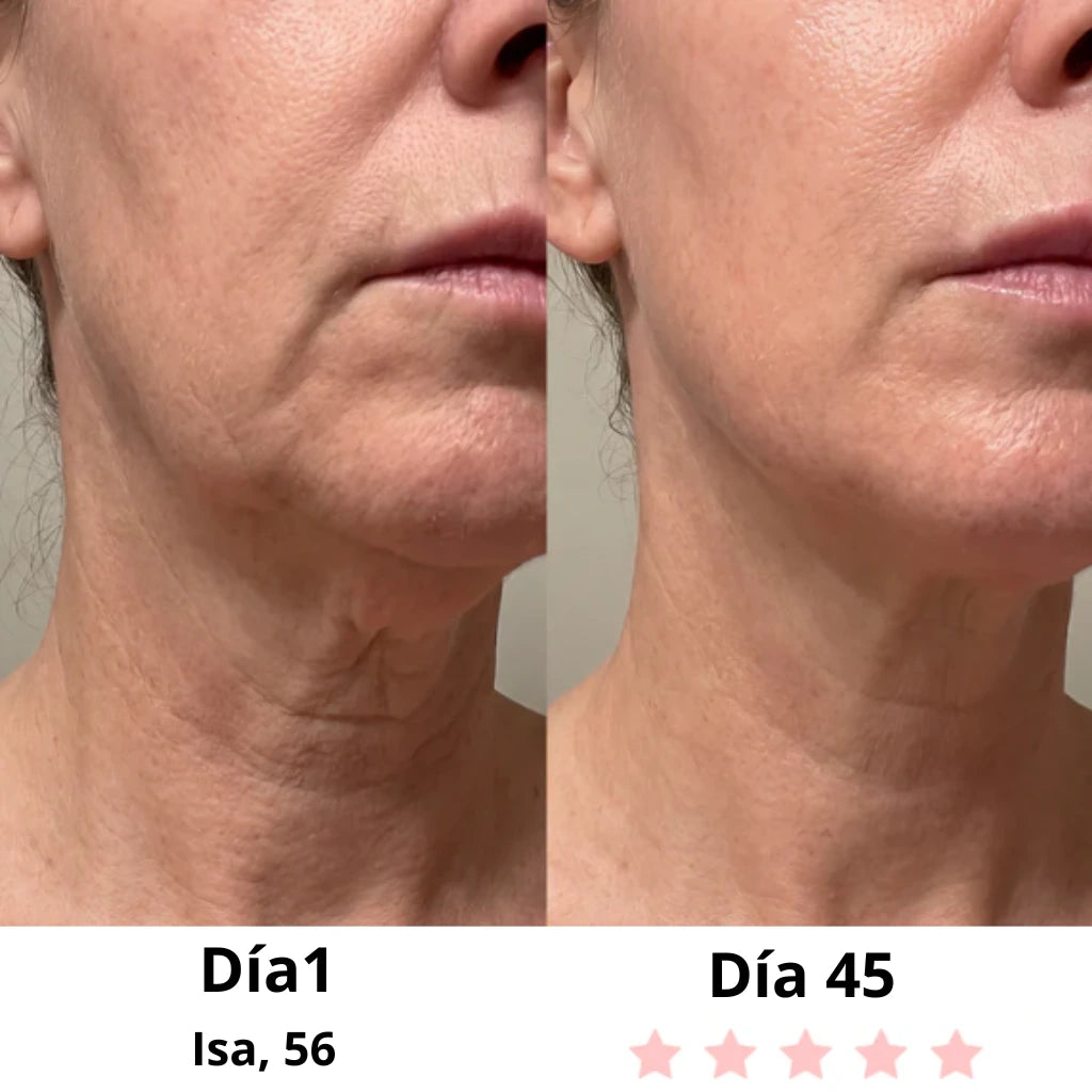 Masajeador facial LED + EMS