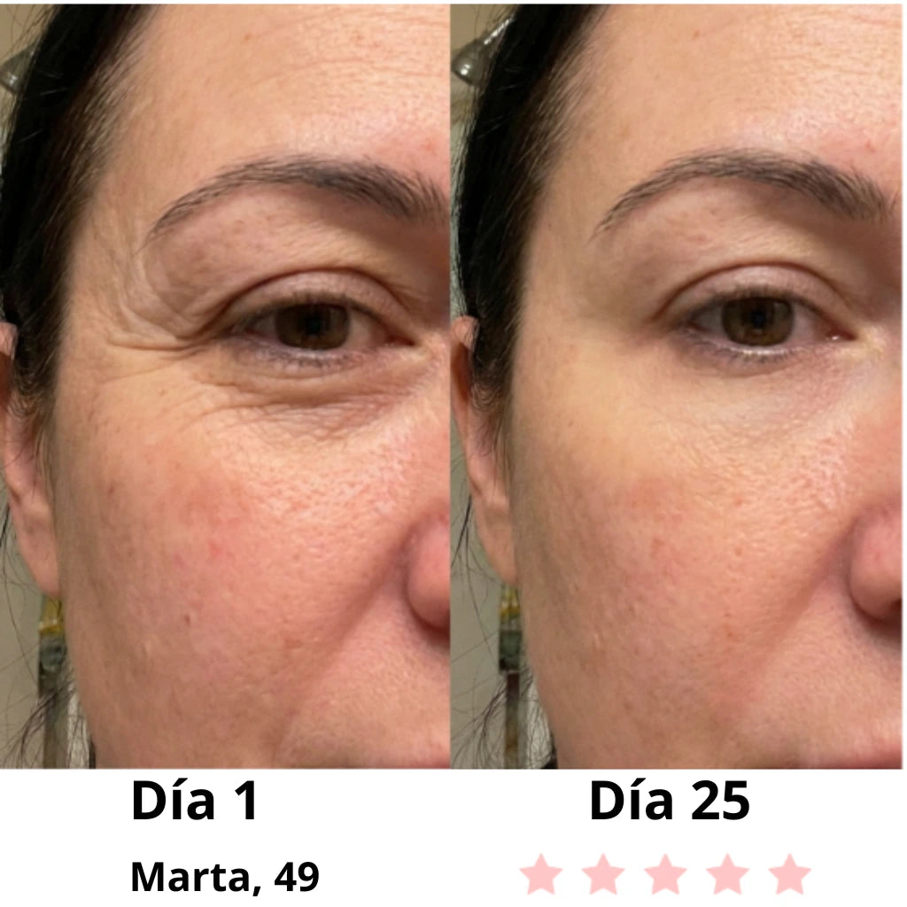 Masajeador facial LED + EMS