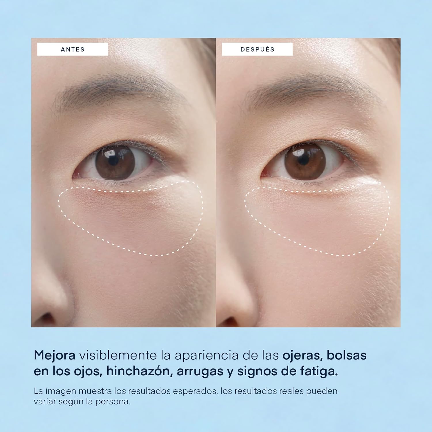 Parches para Bolsas y Ojeras Coreano